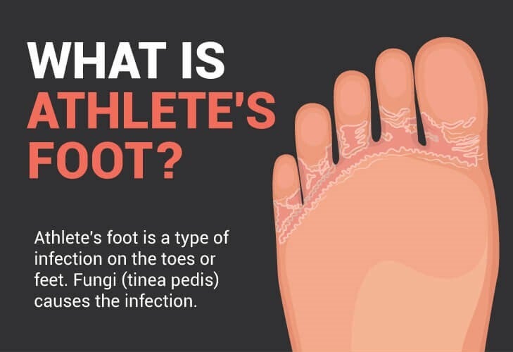 What is the main purpose of pedicure?